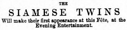 Siamese twins - Bury Free Press (Suffolk) - 16 July 1881